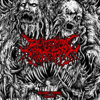 Placental Paralysis : Inevitable Torture